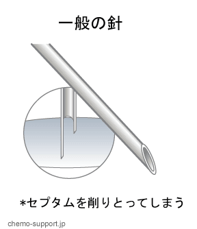 一般の針とヒューバー針（フーバー針）の比較1